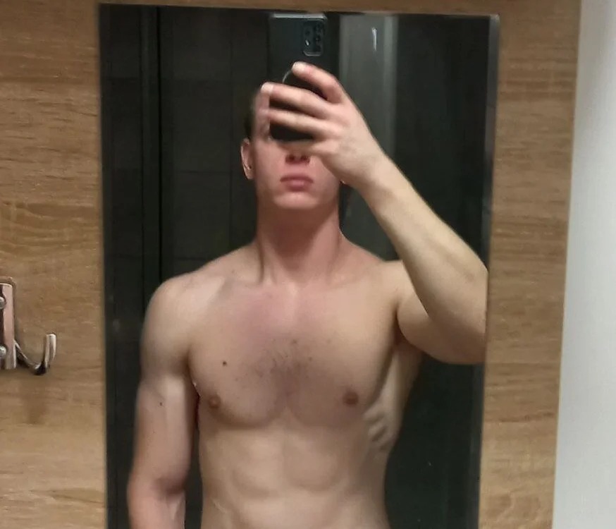 Achillesex22