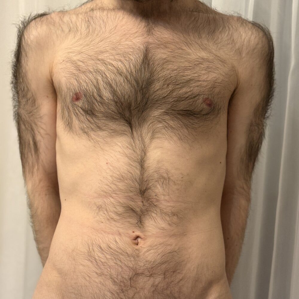 hairybaldboy1