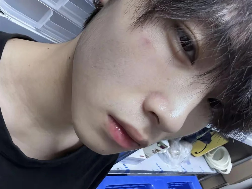 w-lucky02